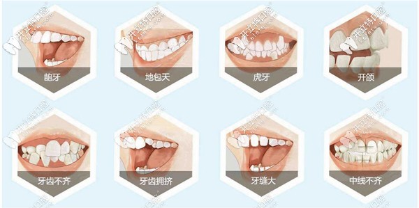 蕪湖矯正牙齒哪家好，這整牙正規(guī)的蕪湖牙科醫(yī)院排名得看