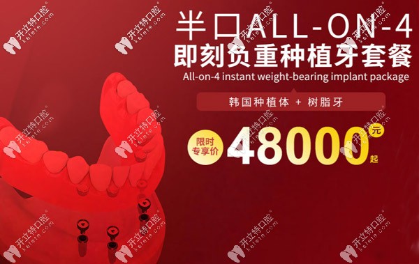 這個(gè)是上海維樂(lè)口腔半口種植牙的活動(dòng)