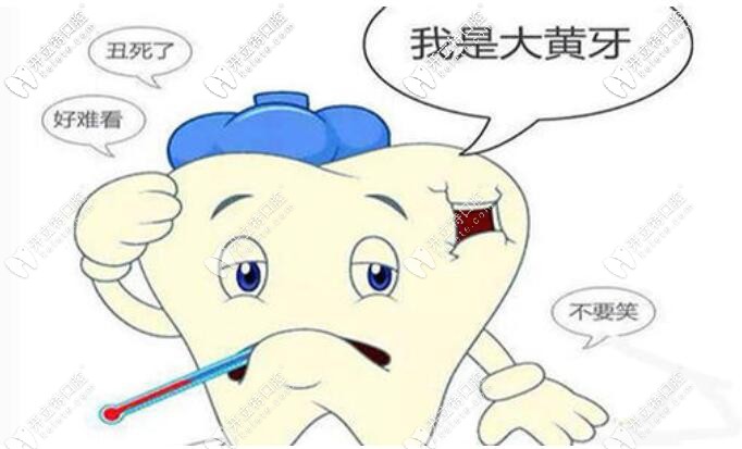 貴州人的牙齒為什么有黃斑?這種氟斑牙通過治療能去掉嗎