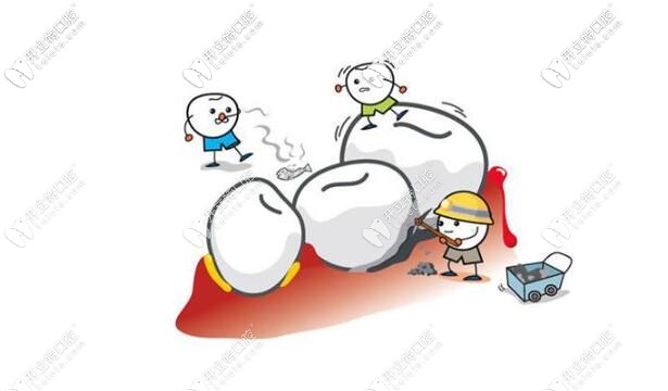 看牙的常規(guī)項(xiàng)目