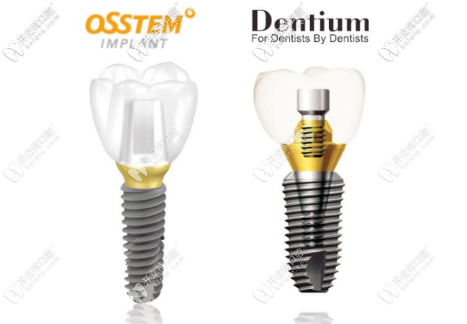 韓國登騰和奧齒泰