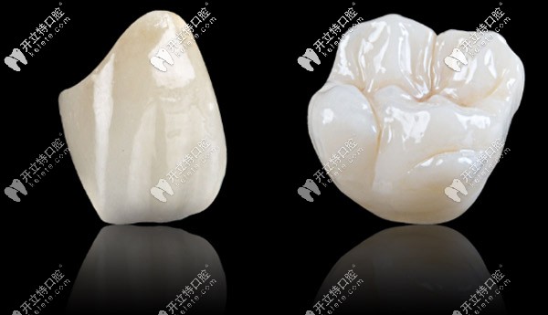 格萊美全瓷牙是進口的嗎，做一顆的價格大概是多少？