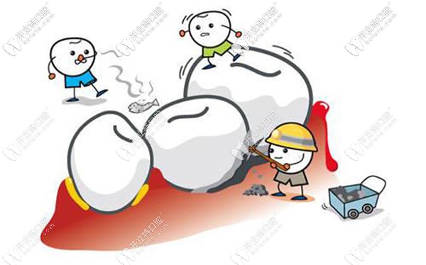 西安洗牙價(jià)格一般多少，西安長(zhǎng)安/未央等11區(qū)潔牙收費(fèi)參考