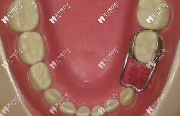 寶寶乳牙缺失該如何處理