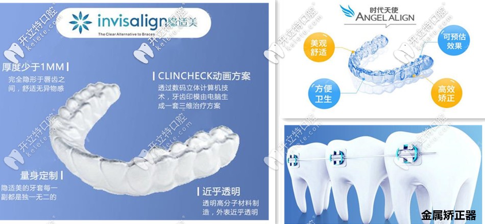 長(zhǎng)沙青橙口腔合作的矯正器含：隱適美、時(shí)代天使等