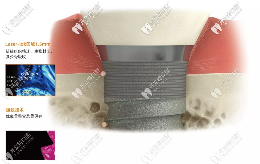 百好瑞植體介紹