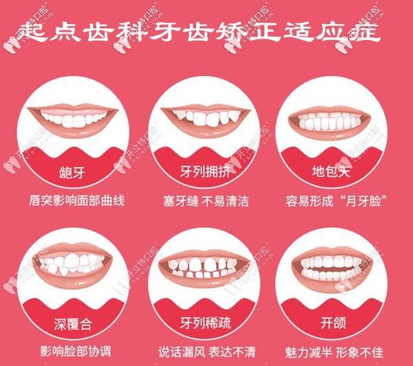 深圳起點口腔牙齒矯正多少錢 深圳起點口腔牙齒矯正多少錢