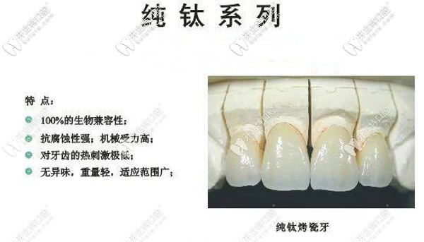 純鈦聚合瓷和烤瓷的區(qū)別大不，后槽牙缺失選哪個更耐用