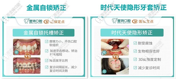 登特口腔：復(fù)雜牙齒矯正案例展示