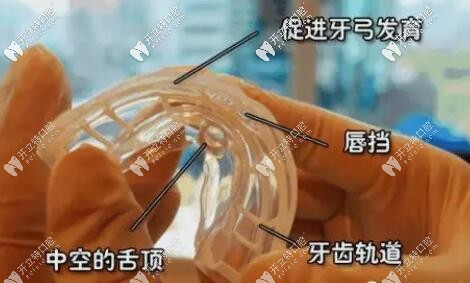 mrc矯治器的作用