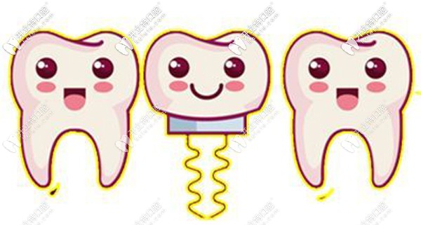 廣州馬瀧齒科種植牙價格
