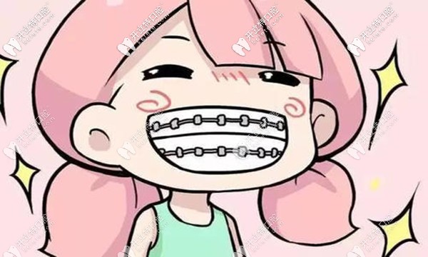 攀枝花明皓口腔矯正牙齒怎么樣,鎖定周虎躍院長的正畸技術