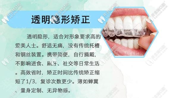 094-隱形牙套優(yōu)勢_副本.jpg