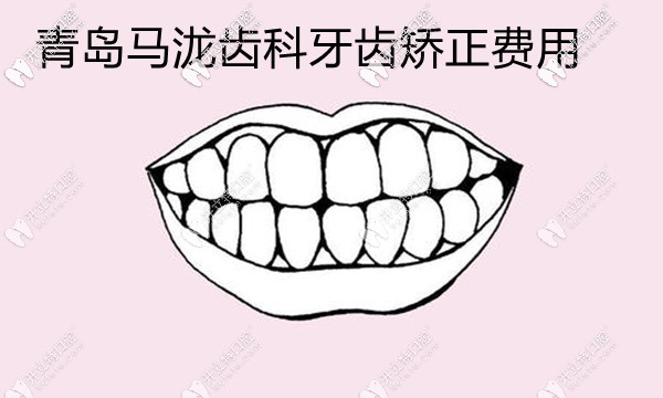 青島馬瀧齒科矯正費用擱這兒呢,找張晗博士做正畸價格貴嗎