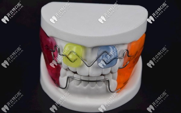 兒童矯治器法蘭克3該怎么調(diào)節(jié),附fr3的使用方法和適應(yīng)癥