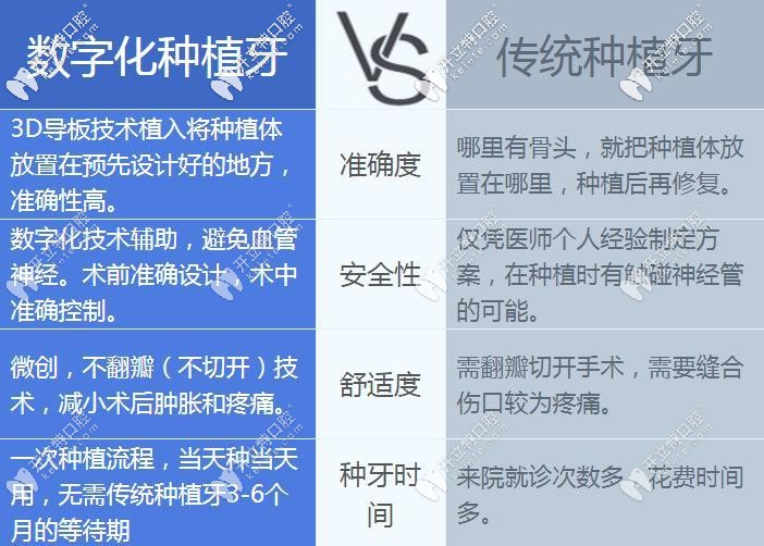 數(shù)字化種植牙和傳統(tǒng)種植牙區(qū)別
