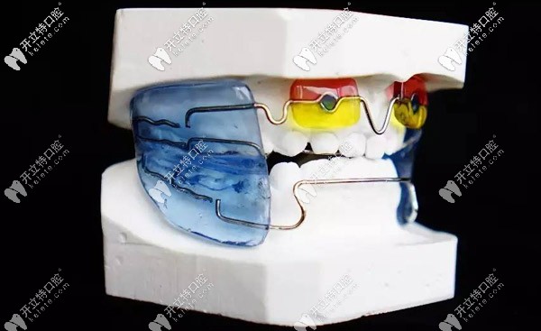 法蘭克3矯正器具體的使用方式與佩戴時間