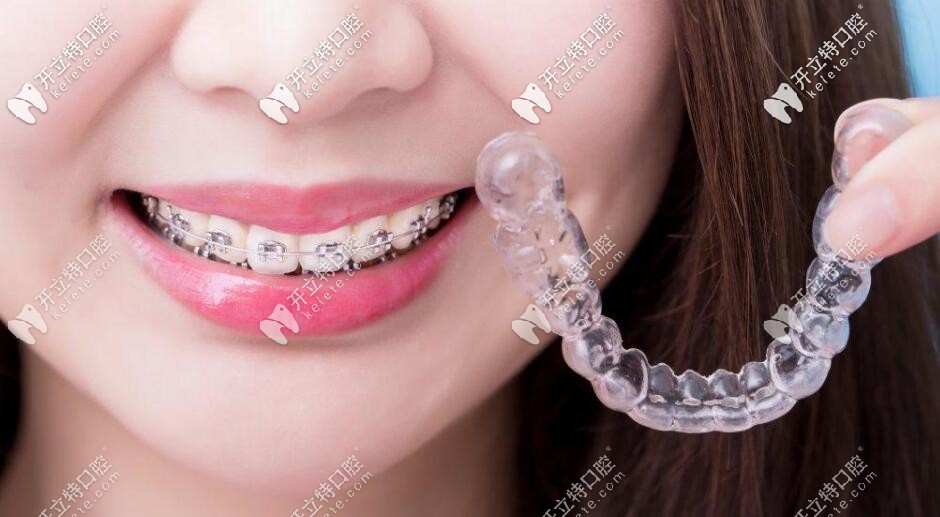  金屬矯正和隱形矯正