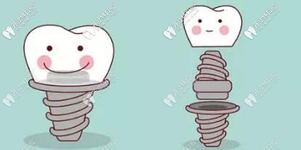 綿陽口腔醫(yī)院收費(fèi)標(biāo)準(zhǔn)更新，種植牙/矯正牙齒價(jià)格同步更新~