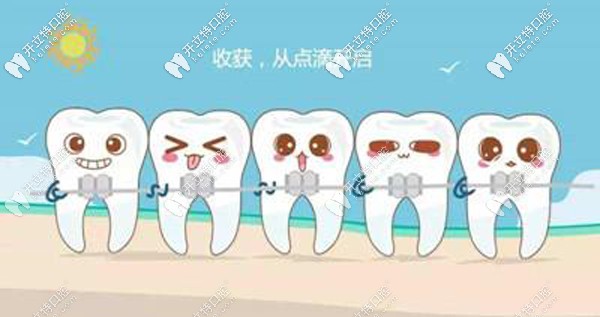 在綿陽做牙齒正畸的費(fèi)用價(jià)格如下