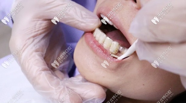 復(fù)診過(guò)程