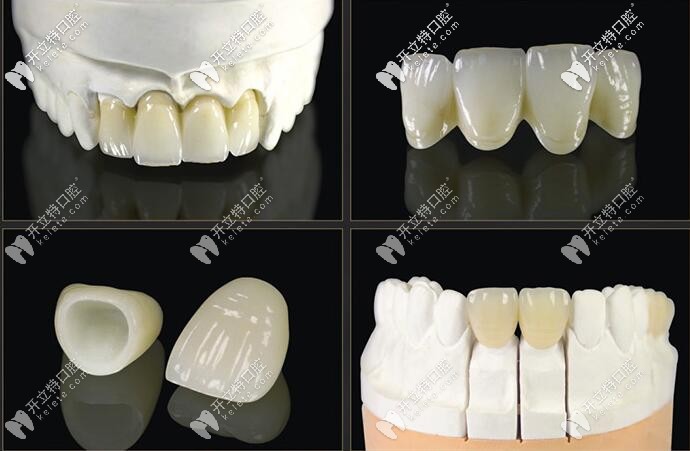 義獲嘉義美展示出來的效果
