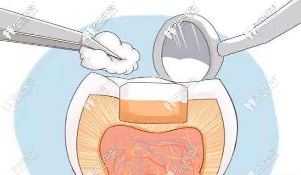 錦州拔牙、洗牙、全瓷牙等牙科項目的價格