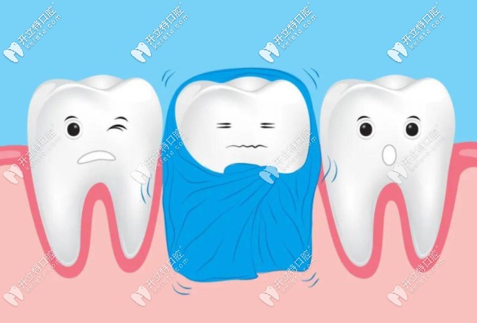 牙齒有黑點(diǎn)但沒有洞需要馬上補(bǔ)嗎？不補(bǔ)的話會(huì)一直蔓延？