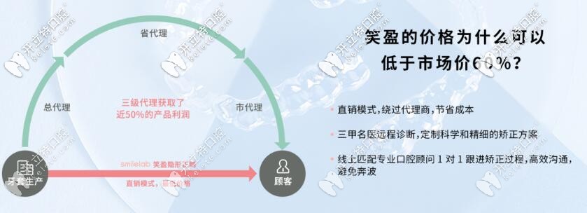 smilelab笑盈全隱形牙套價(jià)格