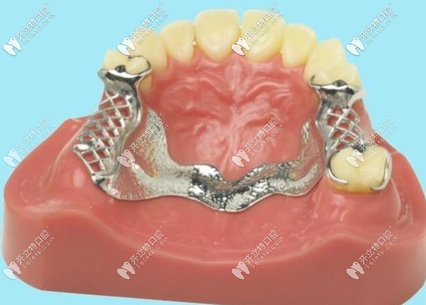 德國(guó)拜耳牙和日本松風(fēng)塑鋼牙哪個(gè)好呢?兩者材質(zhì)有區(qū)別嗎