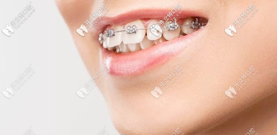 劇透南陽口腔醫(yī)院收費(fèi)價(jià)格表，正畸和種牙費(fèi)用還不貴呢