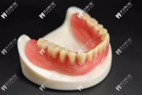 無掛鉤鑲牙是怎么回事?分享無掛鉤假牙的安裝視頻和價(jià)格