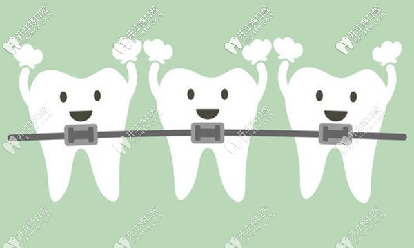 上海羅緣口腔矯正牙齒收費(fèi)價(jià)格并不貴,那正畸技術(shù)咋樣嘞