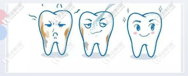 小蘇打刷牙：會有人說變白，只是視覺效果 