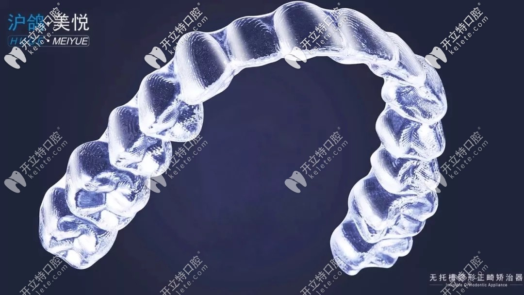 滬鴿美悅矯正器咋樣?關(guān)于滬鴿隱形牙套的價(jià)格及病例這都有