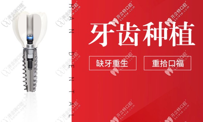 貴陽(yáng)德韓口腔種植牙怎么樣？種牙技術(shù)好的醫(yī)生介紹奉上