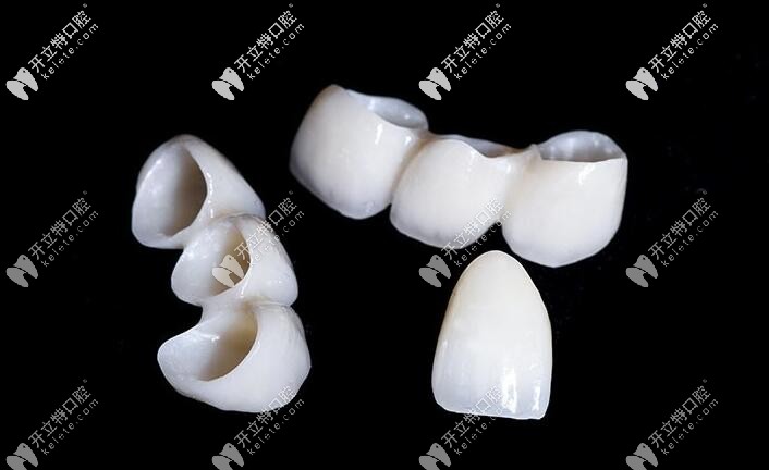 瑞典procera全瓷牙價格辣么貴,算是比較好的進(jìn)口全瓷牙冠品牌嗎