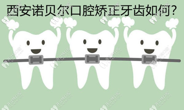 西安諾貝爾口腔矯正牙齒好不好，用正畸病例來(lái)評(píng)價(jià)下