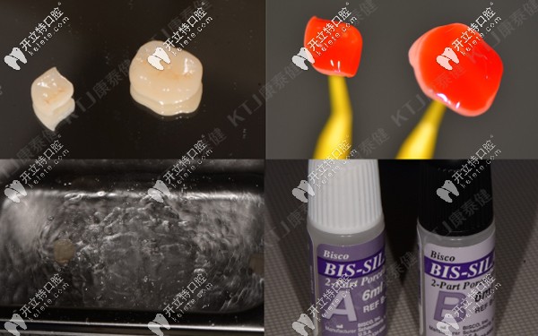 康泰健格萊美瓷嵌體處理