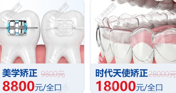 曙光牙科正畸優(yōu)惠活動