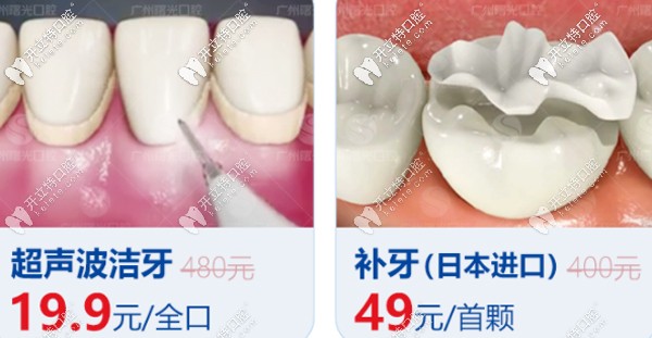 曙光口腔洗牙、補(bǔ)牙優(yōu)惠看這