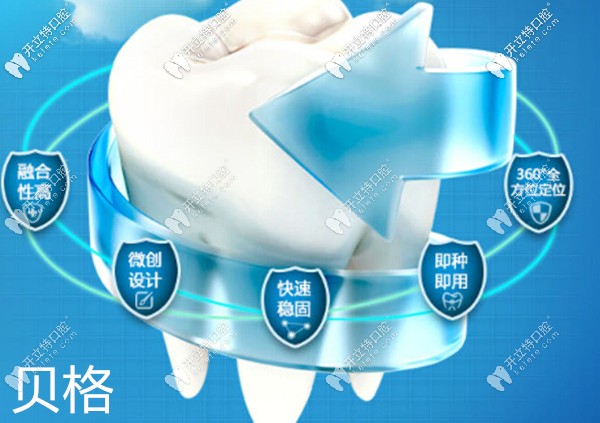 深圳勝健口腔德國貝格種植牙優(yōu)勢 深圳勝健口腔德國貝格種植牙優(yōu)勢