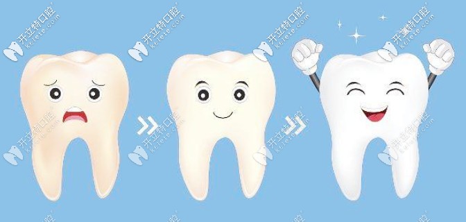 美白牙齒的方法有哪些？這有美牙五大方法效果及優(yōu)勢對比