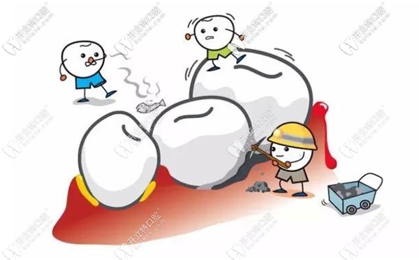 廣州德倫口腔收費標準及地址亮相，看牙弄清價格不迷路哦~