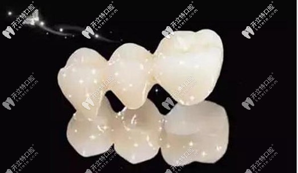 西安美奧口腔全瓷牙價格就在這,不要擔(dān)心國產(chǎn)愛爾創(chuàng)收費貴