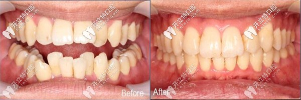 昆明尚愛韓美口腔做自鎖托槽矯正好嗎?看看環(huán)城南路的評價(jià)