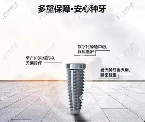 廈門麥芽與瑞典諾?？品N植體聯(lián)合,做Nobel種植牙可終身質(zhì)保