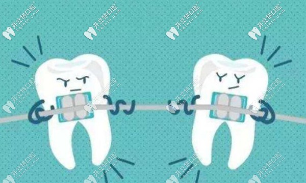 <!--<i data=20240703-sp></i>-->整牙好不好