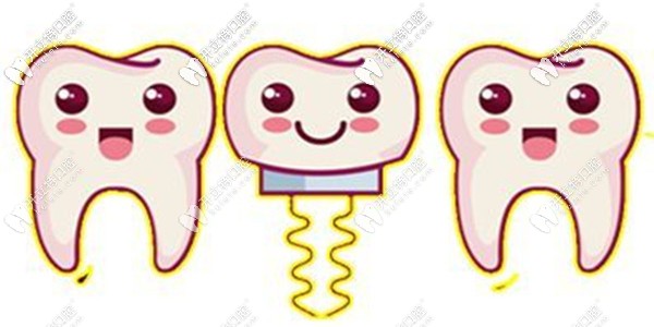 博韻口腔種植牙多少錢