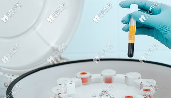 什么是生長(zhǎng)因子種植牙技術(shù) 什么是生長(zhǎng)因子種植牙技術(shù)